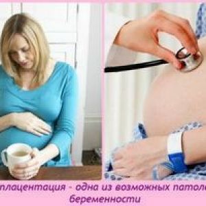 �������� ������ ��� ������ �����������