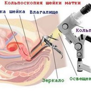 ˳������� ���糿 ��� ��������