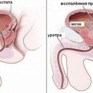 �� ����� ��������� ��������� ��������� � �� ���� �� ��������