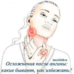 ����������� ���� �����: �� �������, �� ��������?