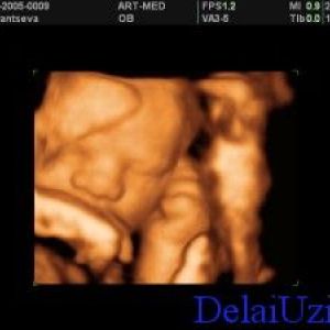 �������� � 32 �����